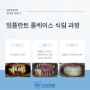 구로중앙치과의원 | 안중읍 화양지구 포승 중앙 치과 "임플란트로 바뀐 삶, 식사량 2배 증가한 감동 후기"