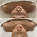 건강미 피부관리 | [청담] 건강미스파 청담, 2026 웨딩 관리 내돈내산 후기 | 웨딩프로그램 + 윤곽관리 가격 공유