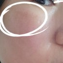 세라샤인 | 40대 후반 피부과 시술 후기(피코슈어, 포텐자, 스킨보톡스, 릴리드M, 슈링크, 인모드FX)