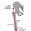 Quadriceps femoralis 의 역학.[medialis의 중요성) 이미지