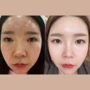 인셀덤신세계