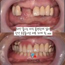 라인치과 네이버블로그