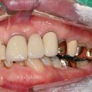 수원탑플란트치과의원 이미지