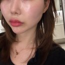 4177 | 대전유성피부관리 엠뷰티24 봉명동 스킨플래닝 추천