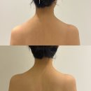 정우상가 맞은 편 | 창원 웨딩 관리 제뉴인에스테틱 승모근 마사지 후기