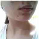 오렌지한의원 이미지