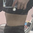 롤리팝성형외과의원 이미지