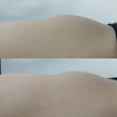 월드컵대로2L | 대전 누워서하는 체지방관리 다이어트 셀포랩 라인업