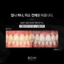 서울보임치과의원 이미지