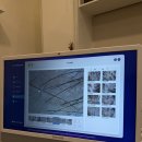 굿볼메소드(야간반) | [두피관리] 부천 WT메소드 부천상동점: 모발강화 프로그램 후기