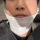 소공지하쇼핑센터 | 명동피부과 남자 수염 레이저제모 고통부터 효과까지 솔직 후기