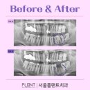 이플랜트치과의원 이미지