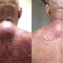 흠평경락관리