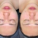 효 | 대구 수성구피부관리 효에스테틱 대만족 후기