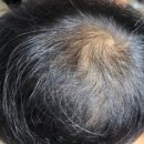 센트리웰뷰티맘 | 두피관리 맥주효모환 &#39;웰로라머거요맥주효환&#39; 후기