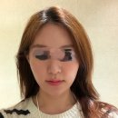 신사역피부과, 쿨소닉 잘하는곳 아르나의원 내돈내산 후기(효과,가격)