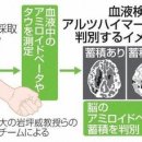 혈액검사로 인지증 판별. 국내 첫 대규모 실증에 성공. 도쿄대학 등. 이미지