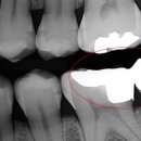 동그라미 치과기공소 이미지