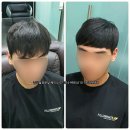 최민헤어샾 | 남자 앞머리 탈모 헤어 증모술 저렴한 가격으로 티안나고 자연스럽게~