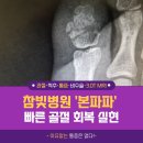 참빛에너지 | 수술 NO! 참빛병원 ‘본파파’로 빠른 골절 회복 실현