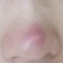 비에이성형외과의원 이미지