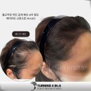 헤어라인 이미지
