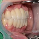 하이브치과기공소 이미지