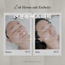 고차원피부관리 | [선유도 피부관리] 어현숙에스테틱 신부관리 솔직 후기 - 꾸준한 관리로 다시 찾은 곳