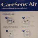 김밥천국임당점 | 연속혈당 측정기 케어센스 에어 후기 - 임당(임신성 당뇨) 아내와 함께하는 혈당 체크!