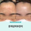 고운손길피부관리