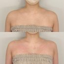 이로 | [안산웨딩케어] 이로에스테틱 승모 관리 후기