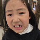 아이꿈꾸는치과의원 | [위례 어린이치과] 유치 발치 잘하는 곳 연세꿈꾸는아이치과의원 송파위례점-내돈내산