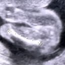 중기검사 세차장 | 임신 중 교통사고 / 배크기 변화 18주 - 22주 태동느끼다!