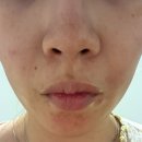 셀앤수 | 셀앤수 세종보람점에서 여드름관리 색소침착 해결 후기