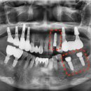 수원탑플란트치과의원 이미지