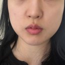 바른토탈케어 | 수원피부관리 뷰티호텔수원점, 복부관리까지 가능한 수원토탈케어 후기