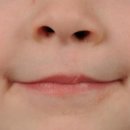 아문성형외과의원 이미지