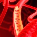 편백효소방 이미지