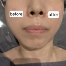 춘주로 | 춘천 피부관리 추천, 상담부터 윤곽관리까지 만족스러웠던 MZ에스테틱 방문 후기