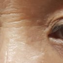 좋은의안 이미지