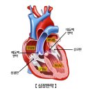 심장판막(Cardiac valves) : 승모판막 / 삼첨판막 이미지