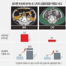 리셋기능비만