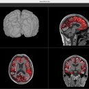 뉴로메디 이미지