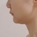 (주)모드 | 홈모드 써마리프트 내돈내산 후기 (7주차)