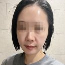 임쁨 | 미사피부관리 임쁨 윤곽관리 솔직후기