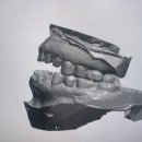 부여치과기공소 이미지