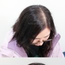 전주동안가발 이미지