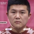 핸드경락 이미지