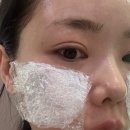 메이필의원 | [메이필의원] 속건조 잡는 물광주사 후기!