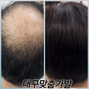 김호증모가발앤행복헤어샵 | 대구 맞춤가발로 완성하는 결혼식의 품격!